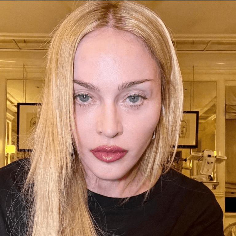 Madonna: Thank You for Radiating Positive Energy Amidst Recent Health Scare