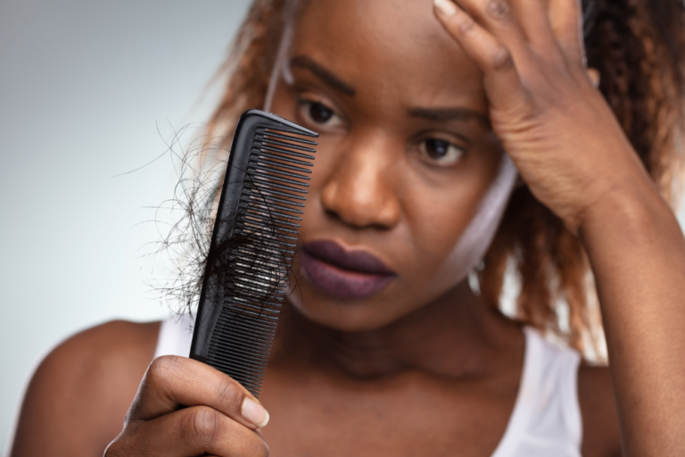 The Challenges of Hair Loss Among Black Women