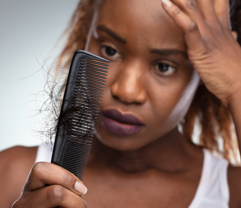 The Challenges of Hair Loss Among Black Women